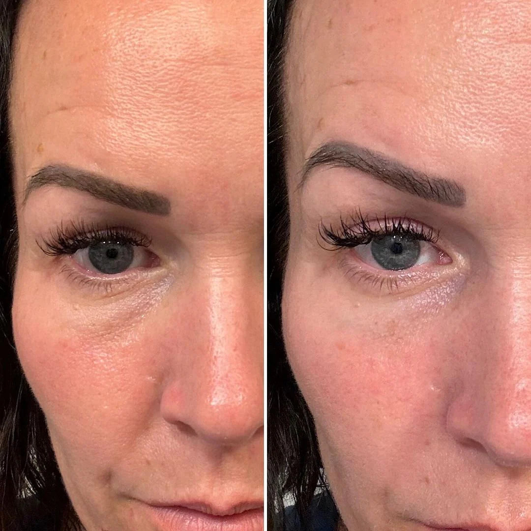 MY SKIN BUDDY Skin Care Device